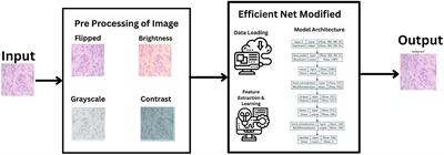 Enhancing accessibility for improved diagnosis with modified EfficientNetV2-S and cyclic learning rate strategy in women with disabilities and breast cancer